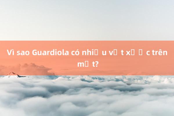 Vì sao Guardiola có nhiều vết xước trên mặt?